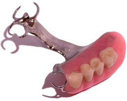 Upper Partial Denture